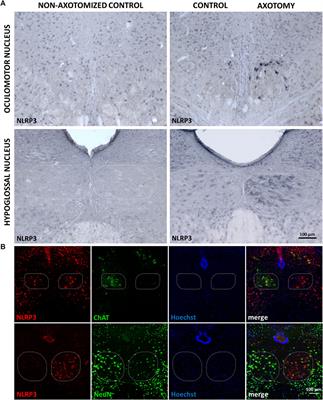 Upregulation of Nucleotide-Binding Oligomerization Domain-, LRR- and Pyrin Domain-Containing Protein 3 in Motoneurons Following Peripheral Nerve Injury in Mice